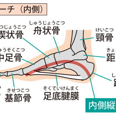 内アーチ